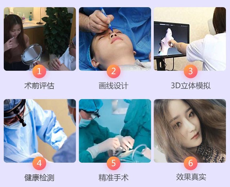 郑州正规整形医院:探索美丽之路